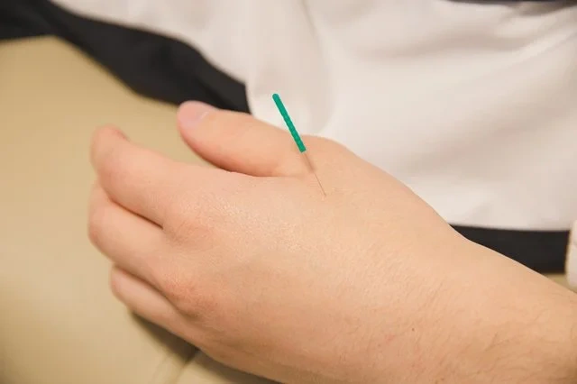 Conditions treated with acupuncture